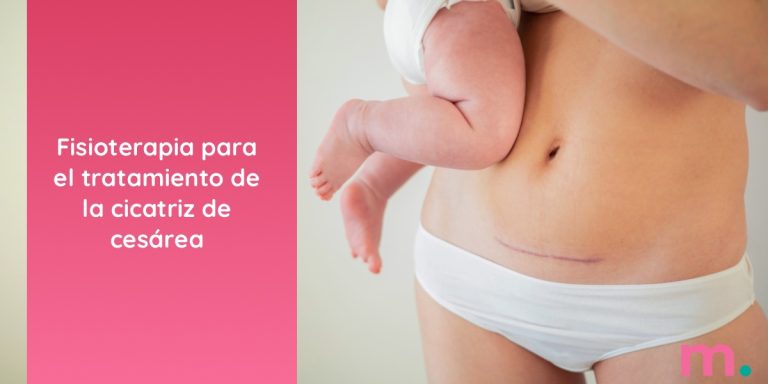 fisioterapia-cicatriz-cesarea-moms-rrss fisioterapia tratamiento cicatriz cesarea